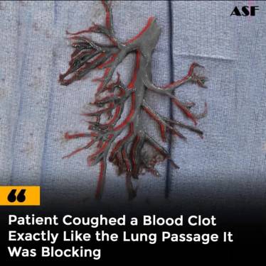 42684